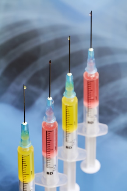 Photo syringes with a drops of medicine on the background of lung x-ray photo. pneumonia medication concept, coronavirus vaccine, curing diseases, protecting. closeup, selective focus