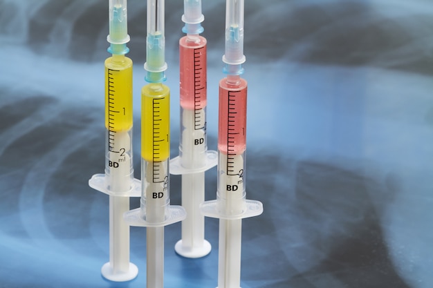 Syringes with various medicines on the background of lung x-ray photo. Pneumonia medication concept, coronavirus vaccine, curing diseases, protecting. Closeup, selective focus