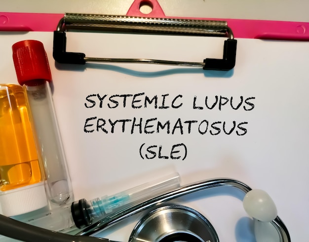 Systemic lupus erythematosus isolated with medical equipment\'s\
on a clip board