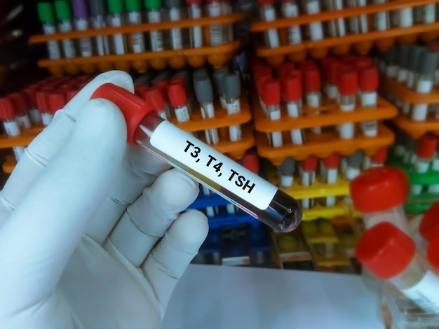 T3 T4 TSH test tube for the hormonal examination of thyroid gland in laboratory