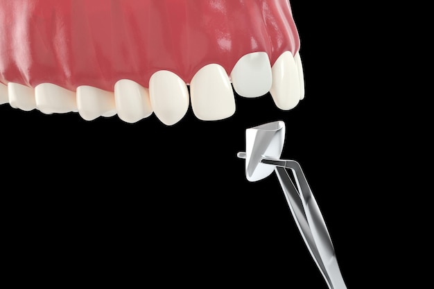 Foto tand menselijke implantaat tandheelkundige implantatie concept menselijke tanden of kunstgebit anddental tools 3d illustratie