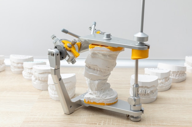 Tandarticulator met tandprothesemodel in tandheelkundig laboratorium