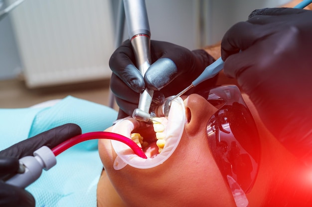 Tanden bleken proces Tandarts biedt proces Patiënt in tandartsstoel Tandkliniek Uitzicht vanaf de top Selectieve focus