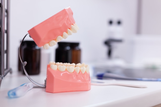 Tanden kaak staande op tafel in orthodontische tandheelkunde ziekenhuiskamer
