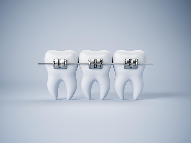 Tanden met of zonder beugels boogbeugels zonder tanden orthodontische tandheelkunde de uitlijning van de tanden gezonde levensstijl en tandheelkundige zorg mooie witte tanden 3d render