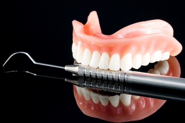 Tandenmodel met een implantaat kroonbrugmodel / tandheelkundige demonstratietandenstudiemodel.