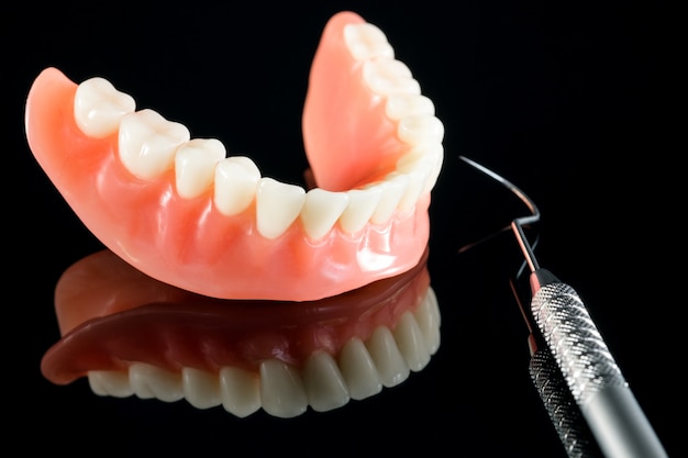 Tandenmodel met een implantaatkroonbrugmodel / tanddemonstratietandenstudie leermodel.