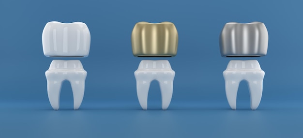 Tandheelkundige implantaten chirurgie 3D-rendering