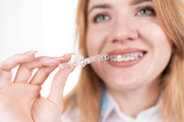 Tandheelkundige zorg Glimlachend meisje met beugels op haar tanden houdt aligners in haar handen en laat het verschil tussen hen zien