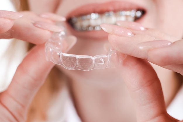 Tandheelkundige zorg Glimlachend meisje met beugels op haar tanden houdt aligners in haar handen en laat het verschil tussen hen zien