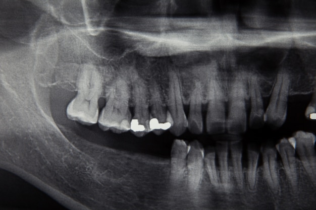 Tandröntgenfilm voor tandverzorgingconcept