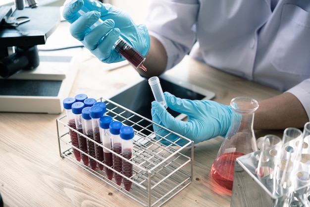 分析のための臨床研究室での血液チューブによる健康技術者、医療、医薬品