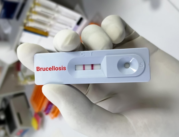 Technician hold rapid test cassette for Brucella infection or Brucellosis