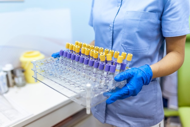 Technician holding blood tube test in the research laboratory Coronavirus testing Doctor taking a blood sample tube from a rack in the lab