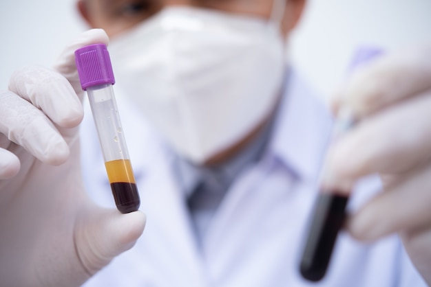 Technician holding centrifuged blood sample in test tube in hospital laboratory