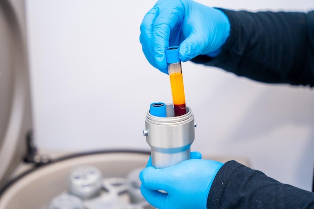 Photo technician holding samples of blue next to centrifuge machine