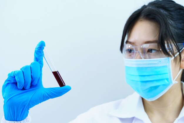 Technician scientist analyzing holding blood sample in test tube in laboratory for testing it on COVID, COVID-19, coronavirus virus analysis