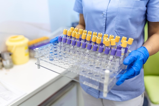 Technicus die een bloedbuistest houdt in het onderzoekslaboratorium Coronavirus-testen Arts die een bloedmonsterbuis uit een rek in het laboratorium neemt