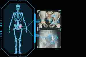 Photo technological digital holographic plate representing the patient's body transverse fracture