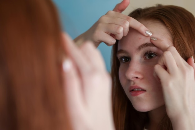 Teen girl with acne problem squeezing pimple indoors