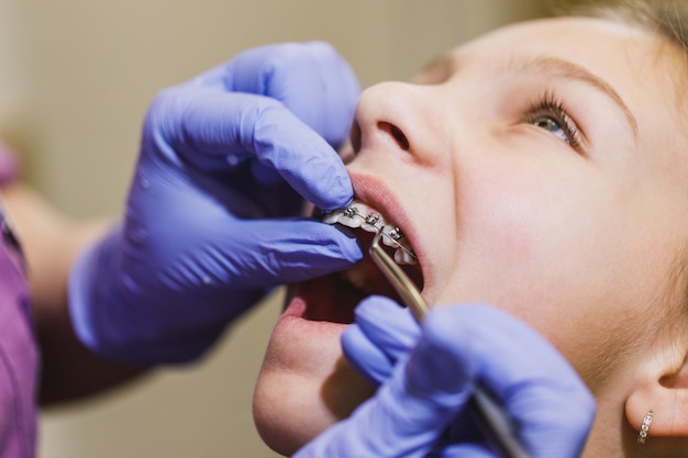 Teenage girl is at the dentist. She sits in the dentist's chair and the dentist sets braces on her teeth.