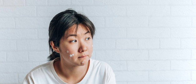 Teenage girl with problematic skin with a therapeutic cream applied white brick wall background