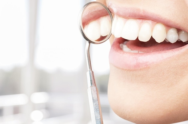 Teeth health concept. Smiling woman mouth under treatment at dental clinic