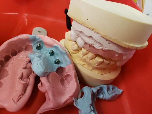 Teeth impression molds