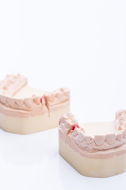 Photo teeth molds on a bright white table