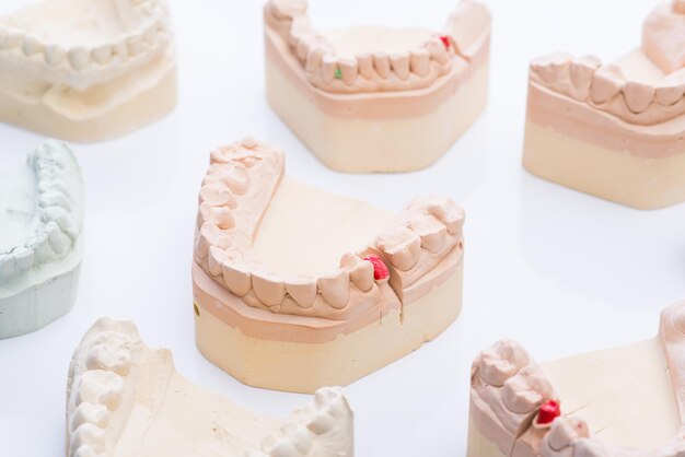 Teeth molds on a bright white table