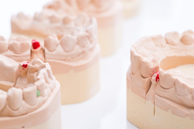 Teeth molds on a bright white table