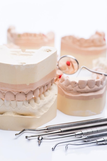 Photo teeth molds with basic dental tools on a bright white table