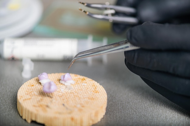 Foto protesi dentali corone dentali preparate per forno e pressa