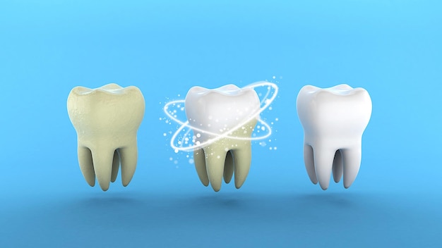 Teeth whitening Tooth with tartar and after ray whitening Blue background 3d render