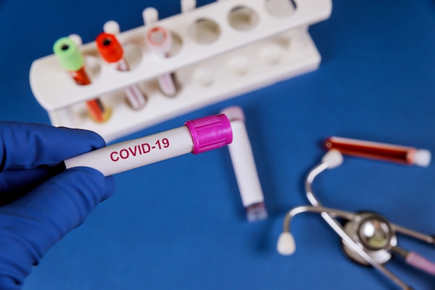 Test tube on an blood test request form for covid-19