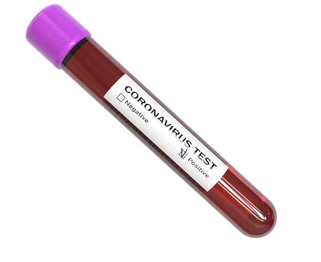 Test tube of Coronavirus Blood tests