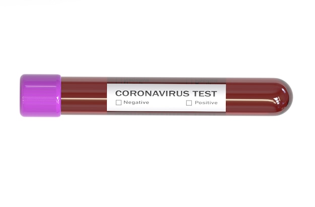 Test tube of Coronavirus Blood tests