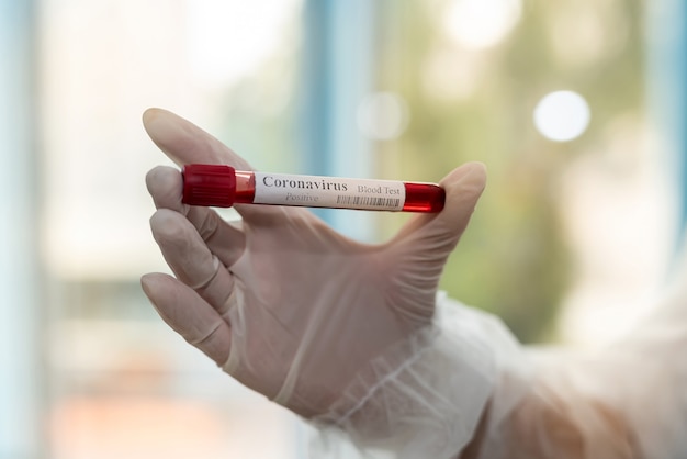 Test tube in female hand with blood sample for testing equipment for Coronavirus COVID19 diagnostic.