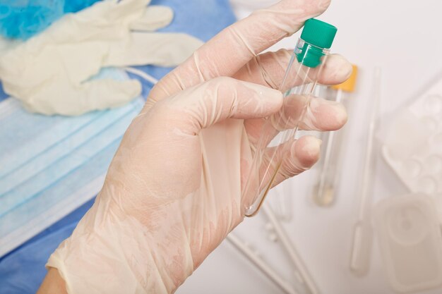 Photo test tube in the hand of a laboratory technician.closeup