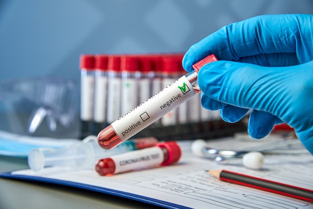 Test tube in hand with a negative blood sample for COVID-19