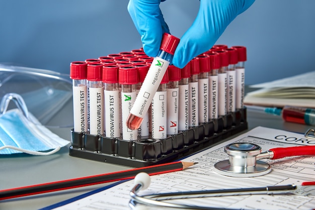 Photo a test tube in hand with negative blood samples for covid-19 next to the coronovirus test form.