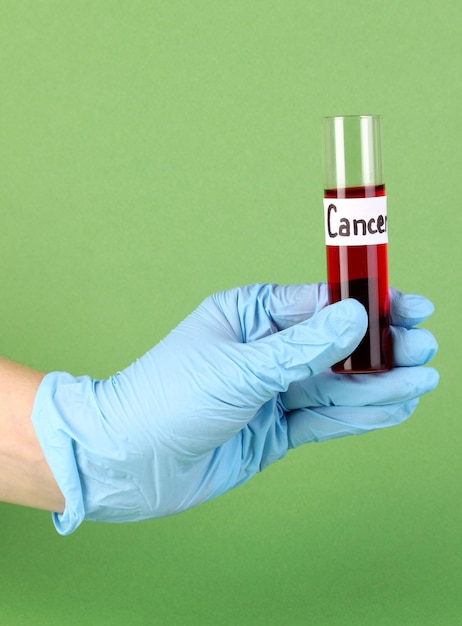 Photo test tube labeled cancer in hand on green background