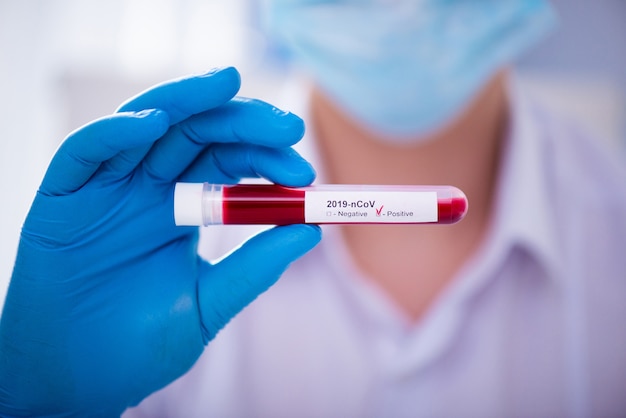 Test tube in male hand close up, doctor in medical mask holding vial with red liquid. Concept blood sample, coronavirus diagnostic, medical research