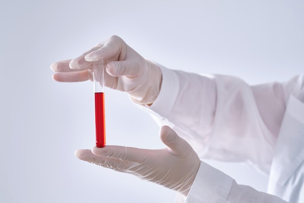 Photo test tube with blood in the hand