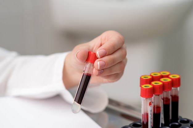 Test tube with blood in hand.