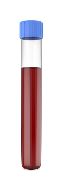 写真 白い背景で隔離の血の入った試験管