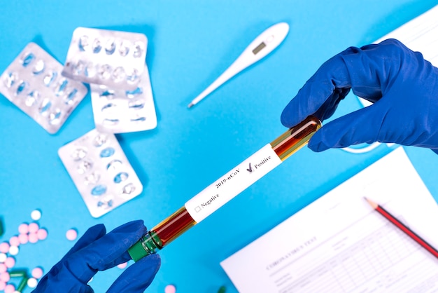 Test tube with blood in medical blue gloves . Coronovirus test analysis