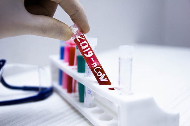 Photo test tube with blood test for coronavirus in laboratory