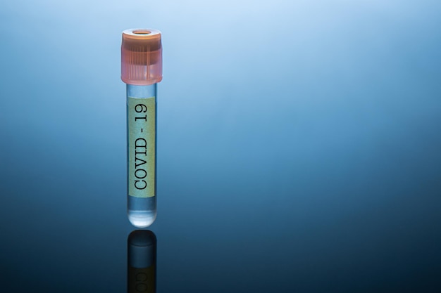 Test tube with coronavirus vaccine on reflective surface. Website banner