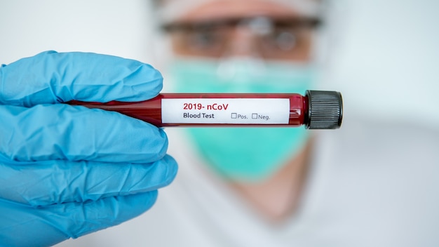 Test tube with infected blood sample for COVID-19